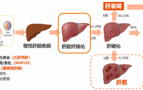 看见新力量|国产FibroScan® Pro无创肝病检测仪成医疗健康新热门