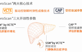 FibroScan® 无创肝脏检测设备检查一次多少钱？